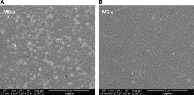 Artificial water channels-embedded PVDF membranes for direct contact membrane distillation and ultrafiltration